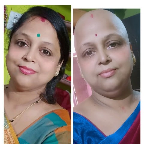 Cancer journey Cancer journey