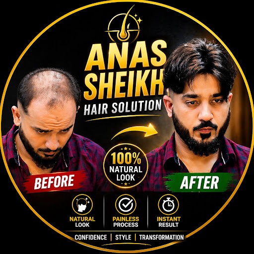 Permanent Hair Patch Delhi Permanent Hair Patch Delhi